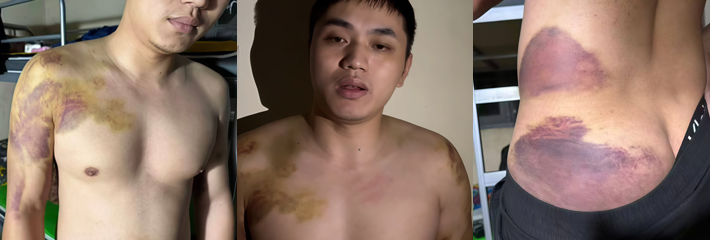 中国公民 穆昌俊 在泰国被非法倒卖至缅甸 拘禁现场视频曝光 30万赎金让家人彻底绝望