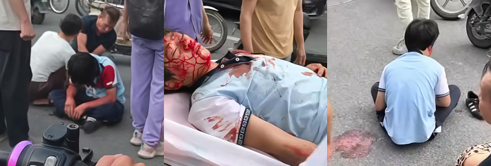 潮州沙溪镇车祸血腥现场 学生满脸是血倒地不起 120救援画面曝光